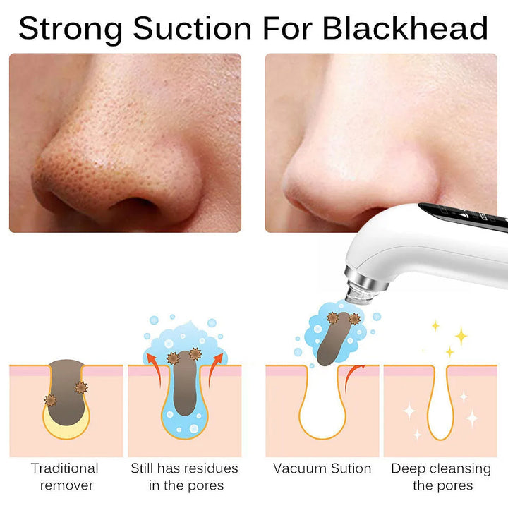 Sleek, portable electric pore vacuum for targeted blackhead removal & personal skincare.