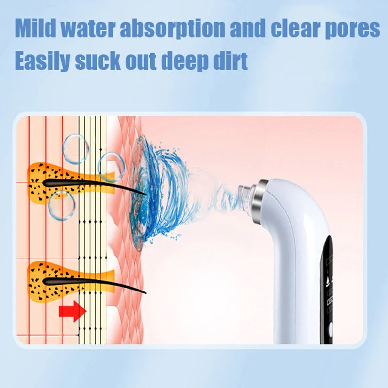 Electric blackhead remover pore vacuum with various suction heads for personalized skincare.