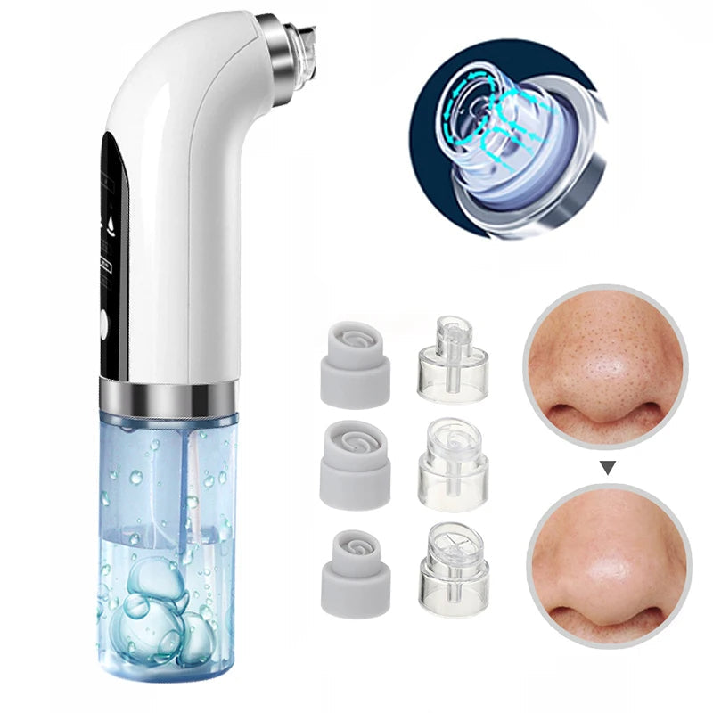 Effective electric pore vacuum for treating acne, blackheads, and improving skin texture.