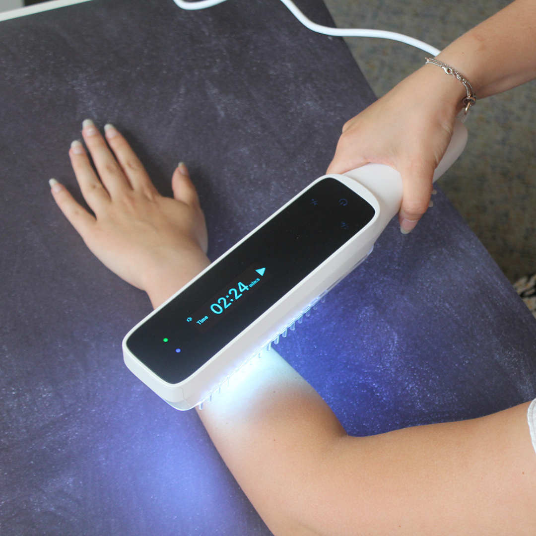 Handheld UVB phototherapy lamp for psoriasis & vitiligo treatment. Compact device for home skin light therapy.
