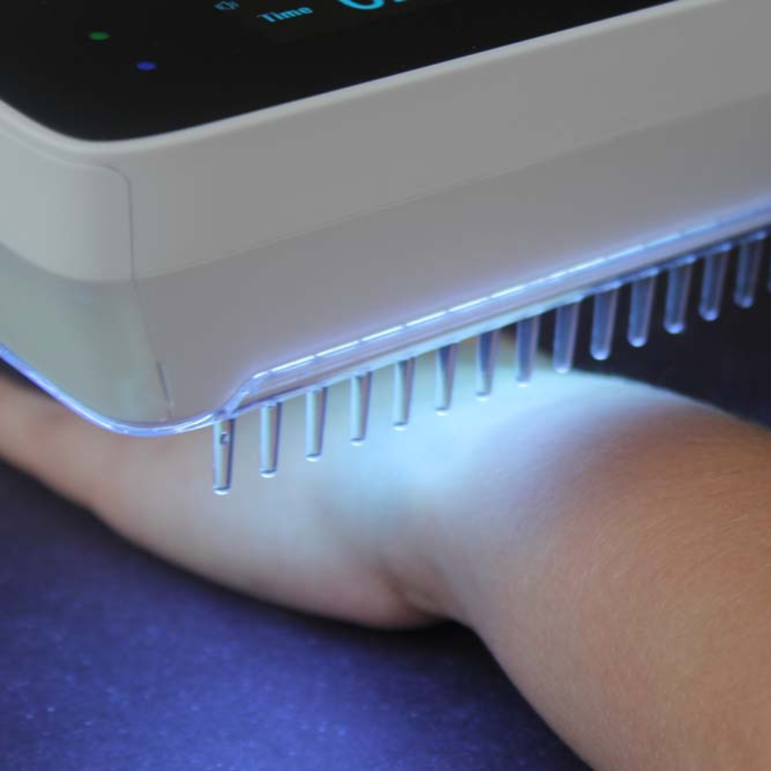 Portable UVB phototherapy lamp. Effective handheld device for home treatment of psoriasis, vitiligo, and eczema.