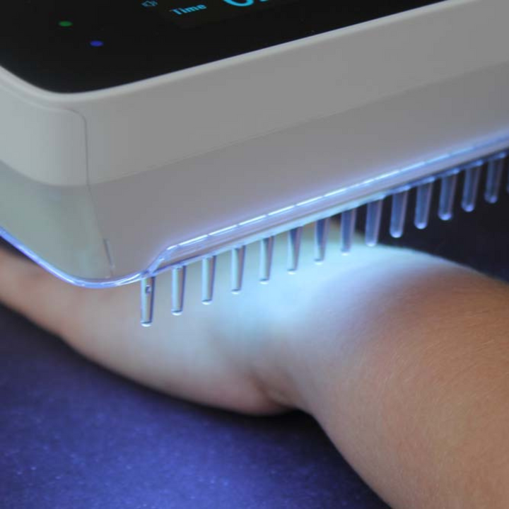 Portable UVB phototherapy lamp. Effective handheld device for home treatment of psoriasis, vitiligo, and eczema.