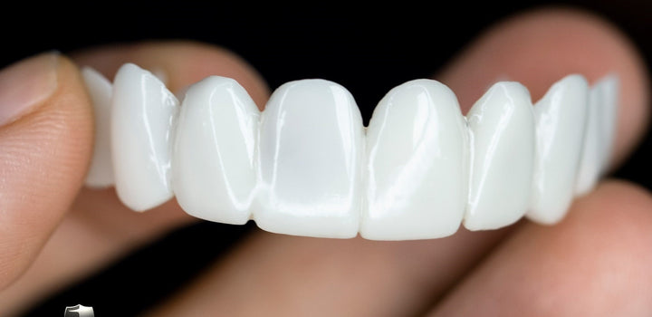 Instant Aesthetic Smile Veneers - A natural-looking, cosmetic dentistry solution for smile enhancement.