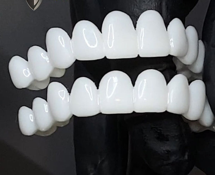 These removable tooth veneers offer an instant aesthetic smile, boosting confidence.