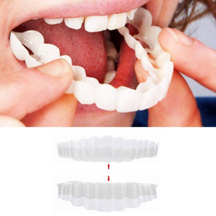 Full set of Instant Smile Veneers: upper and lower for complete cosmetic teeth coverage. Achieve a perfect smile at home.