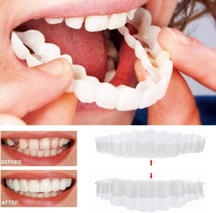 Achieve perfect teeth instantly with these snap-on veneers. At-home dental beauty solution for a brighter, confident smile.