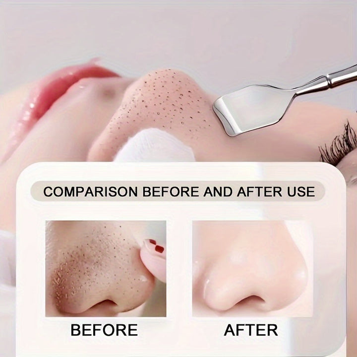Ergonomic double blackhead remover, essential for deep pore cleansing and preventing acne breakouts.